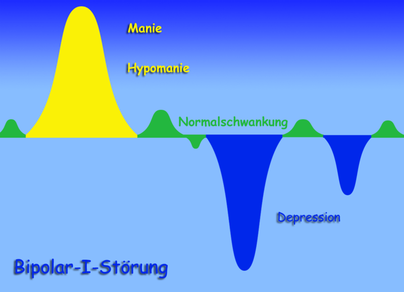 Datei:Bipolar1 entwurf.png