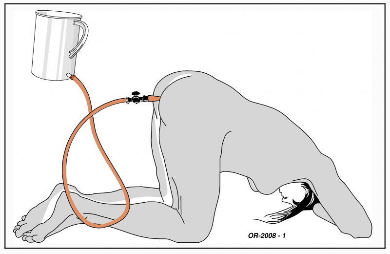 Datei:OR-2008-1-enema-redraw.jpg