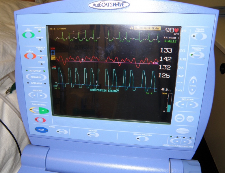 Datei:IABP-Monitor.jpg